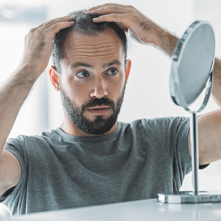 perte-de-cheveux