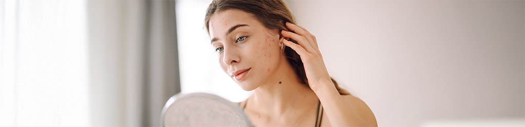 peau-à-imperfections