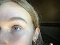 BP_1068862_enhance_review_media_8629332444 BP_1068862_enhance_review_media_8629332444