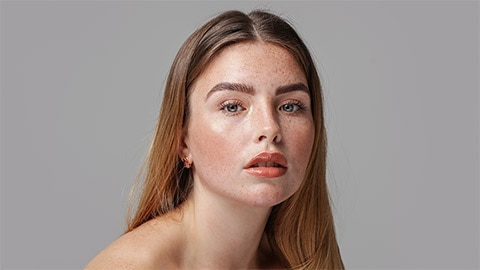 freckles freckles