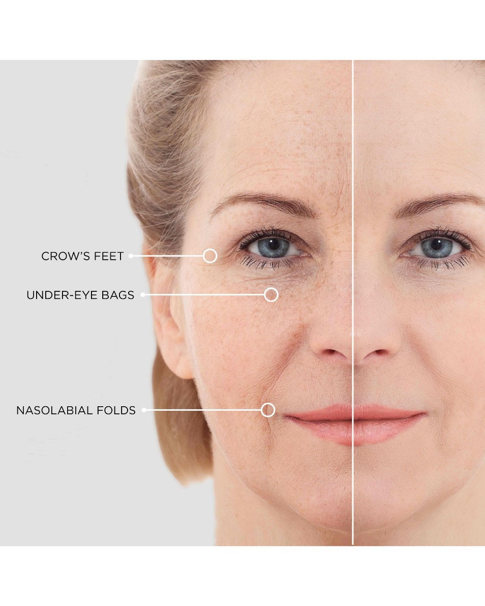 HYDRATANT ANTI-RIDES