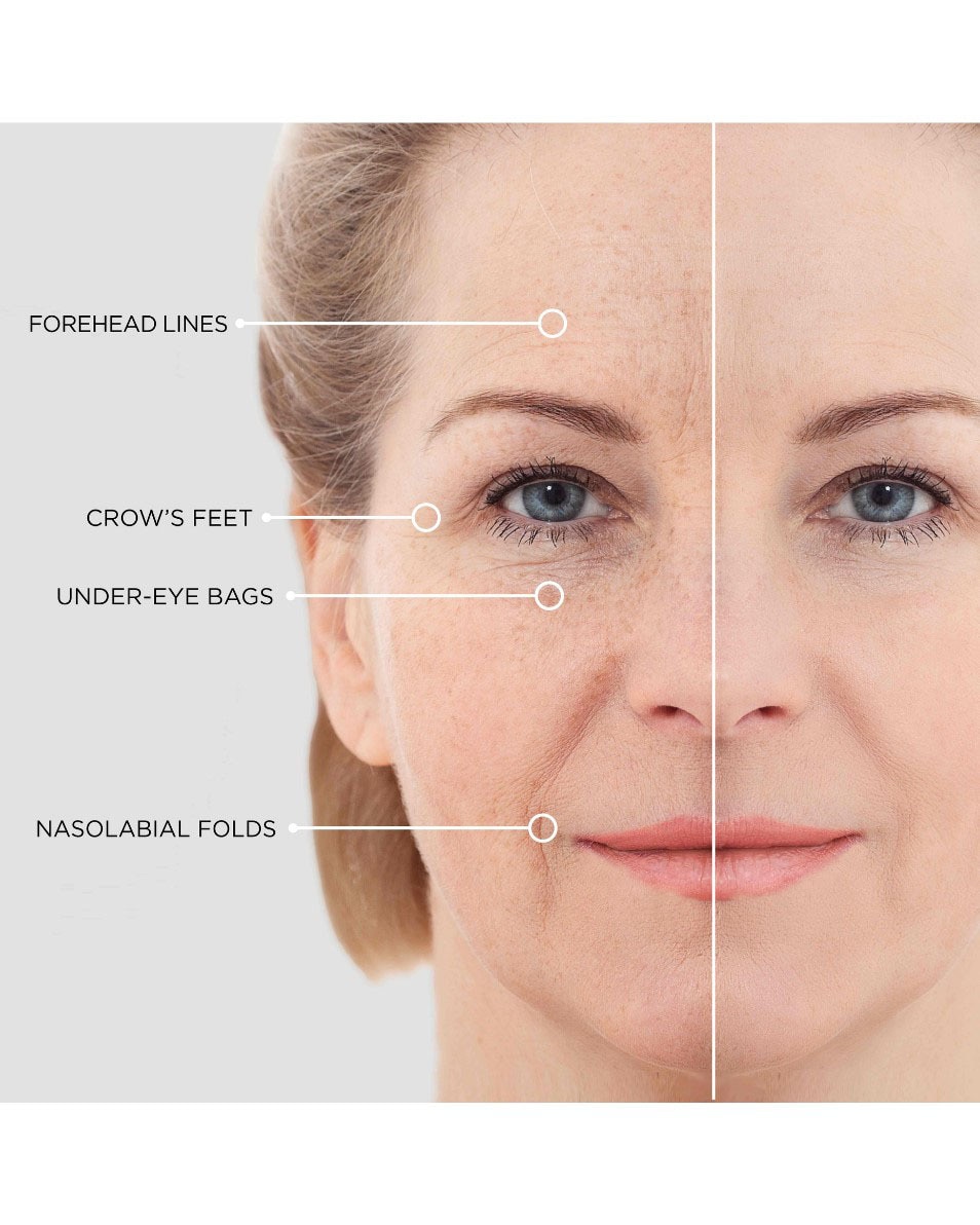 BEAUTICAL INSTANT LIFTING SERUM VERMINDERING VAN FIJNE LIJNTJES EN RIMPELS 15 ML 3