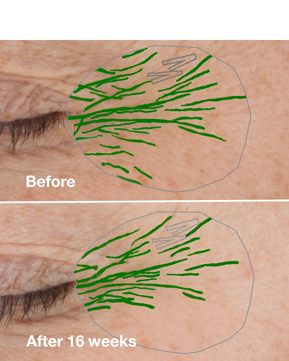 CLINIQUE CLINIQUE SMART CLINICAL REPAIR™ WRINKLE CORRECTING RICH CREAM ANTI-AGING HYDRATERENDE CRÈME - DROGE HUID 50 ML 3