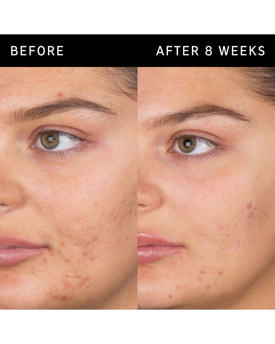 SALICYLZUUR REINIGER