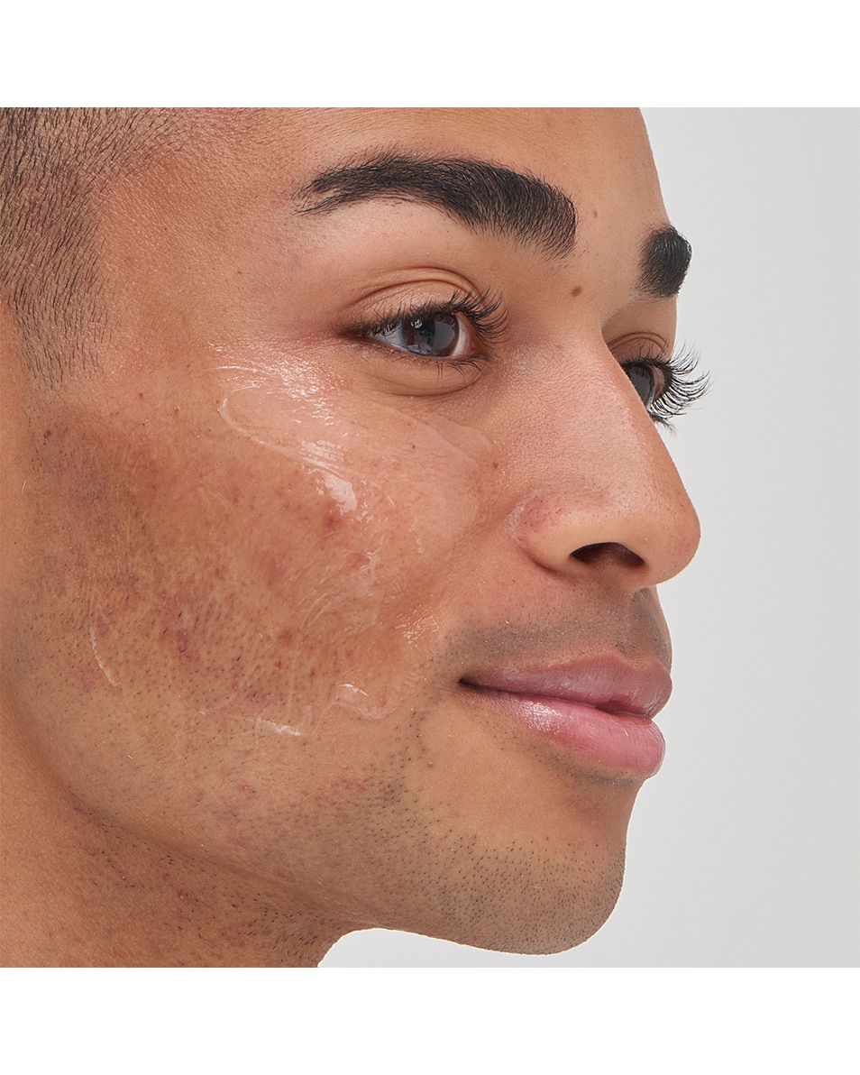 SOIN À L'ACIDE TRANEXAMIQUE