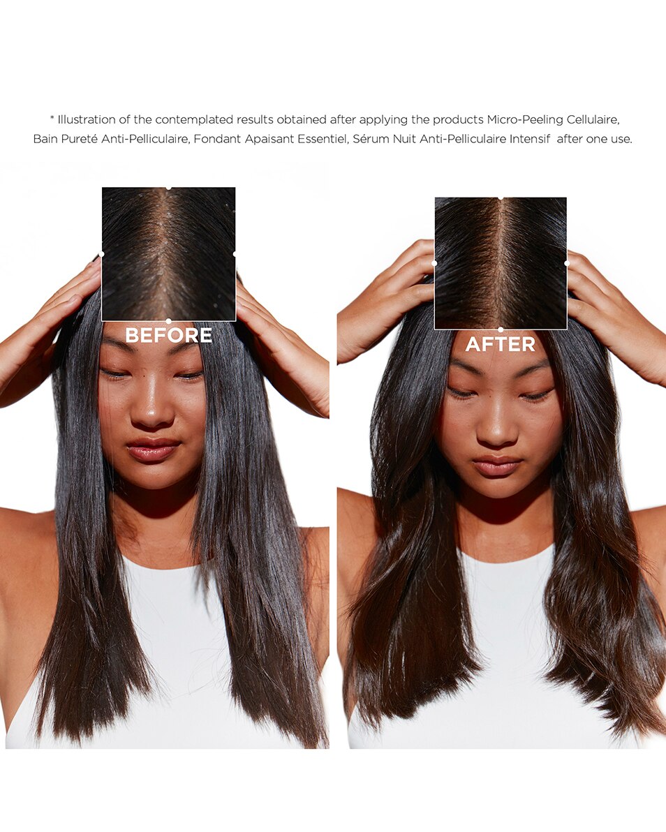 Après-shampooing Anti-Pelliculaire Démêlant Apaisant