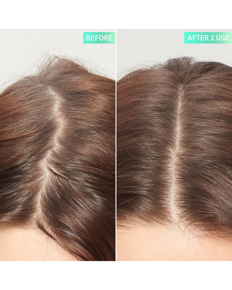 The Inkey List HAIRCARE GOMMAGE EXFOLIANT POUR CUIR CHEVELU À L'ACIDE GLYCOLIQUE 150 ML 3