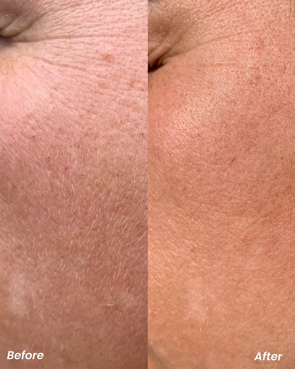 CLAY AND GLOW Retinol Nacht Serum Serum 30 ML 3