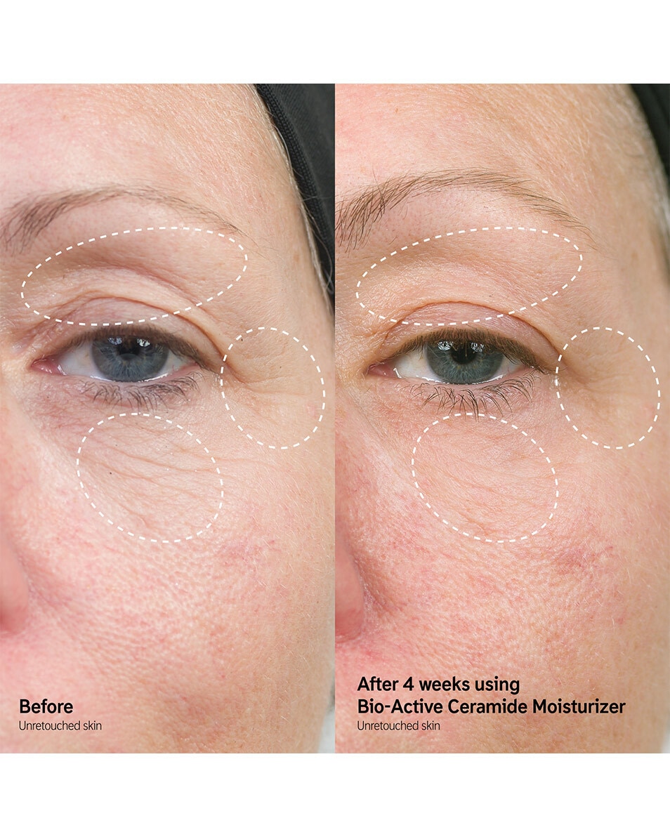 Herstellende en vollere moisturizer