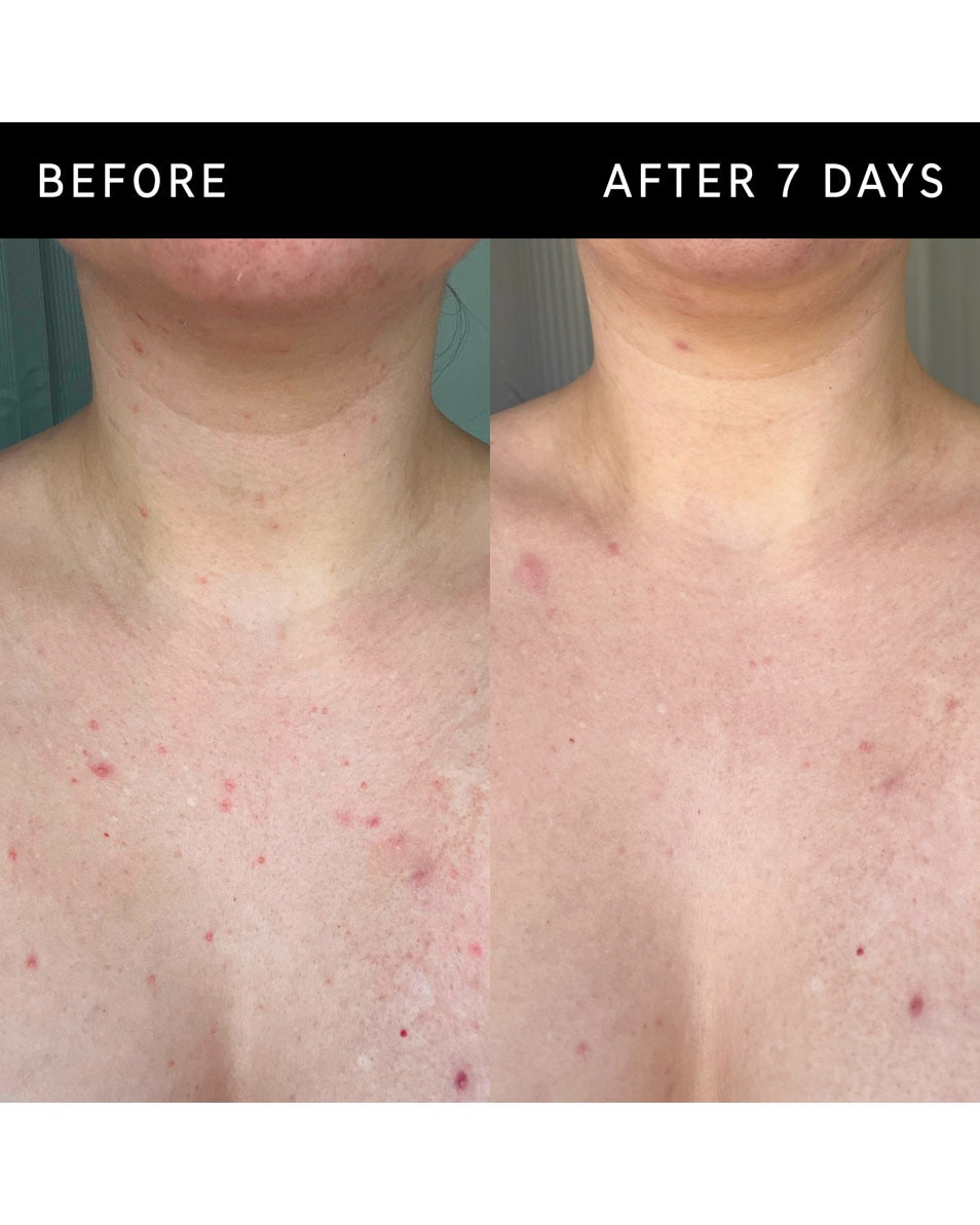 Exfoliërende bodystick met glycolzuur