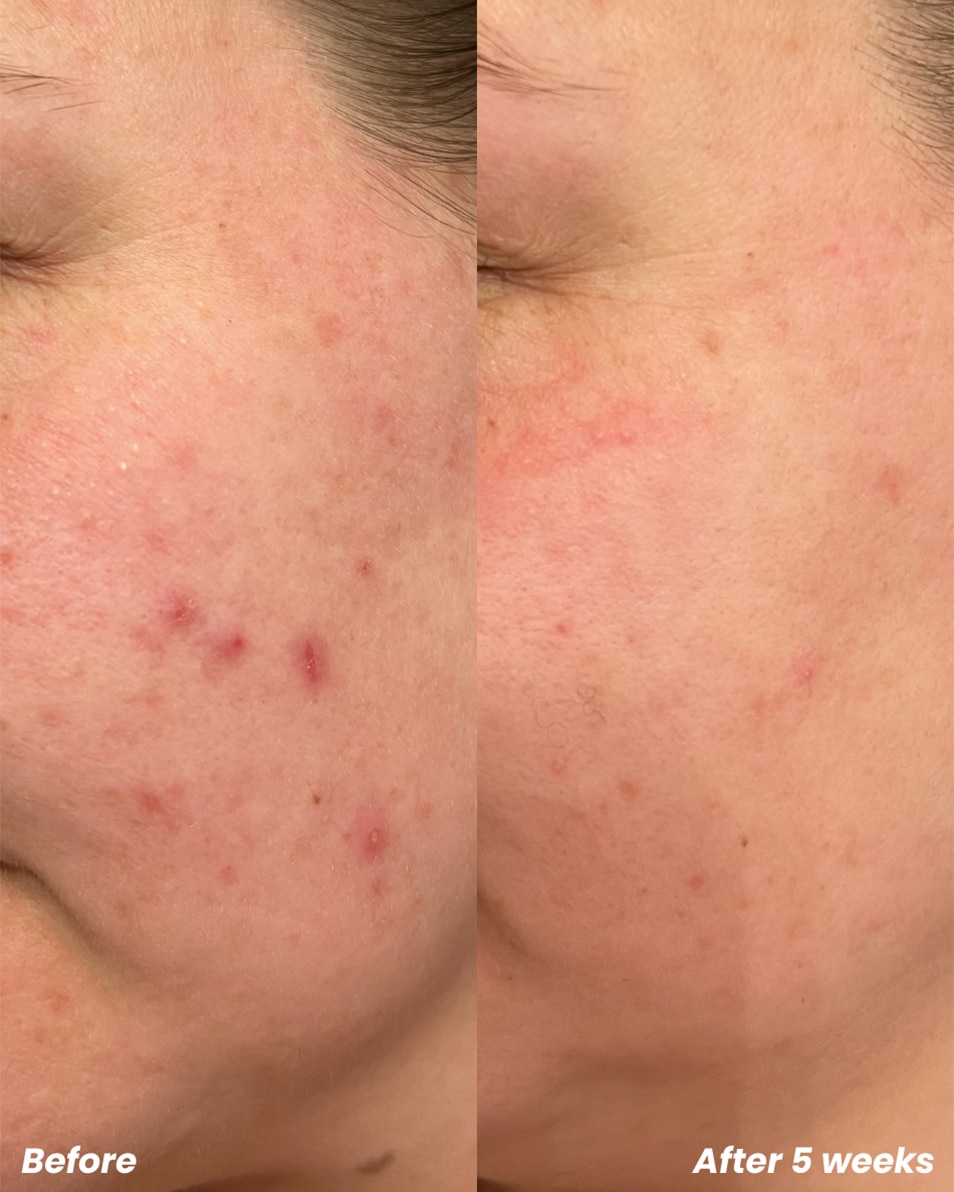 CLAY AND GLOW Exfoliant BHA/AHA Exfoliant 125 ML 3