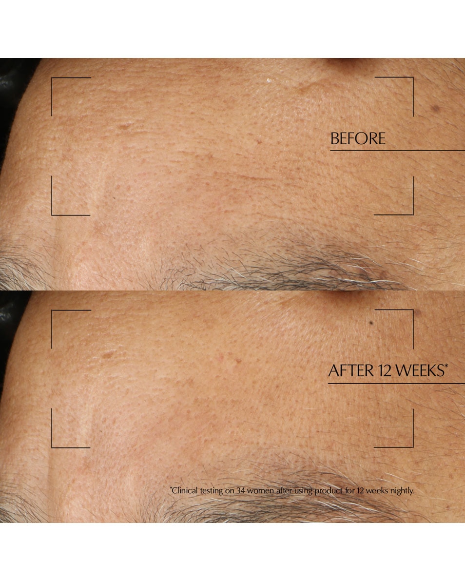 Intensieve nachtverzorging met Hyaluronzuur