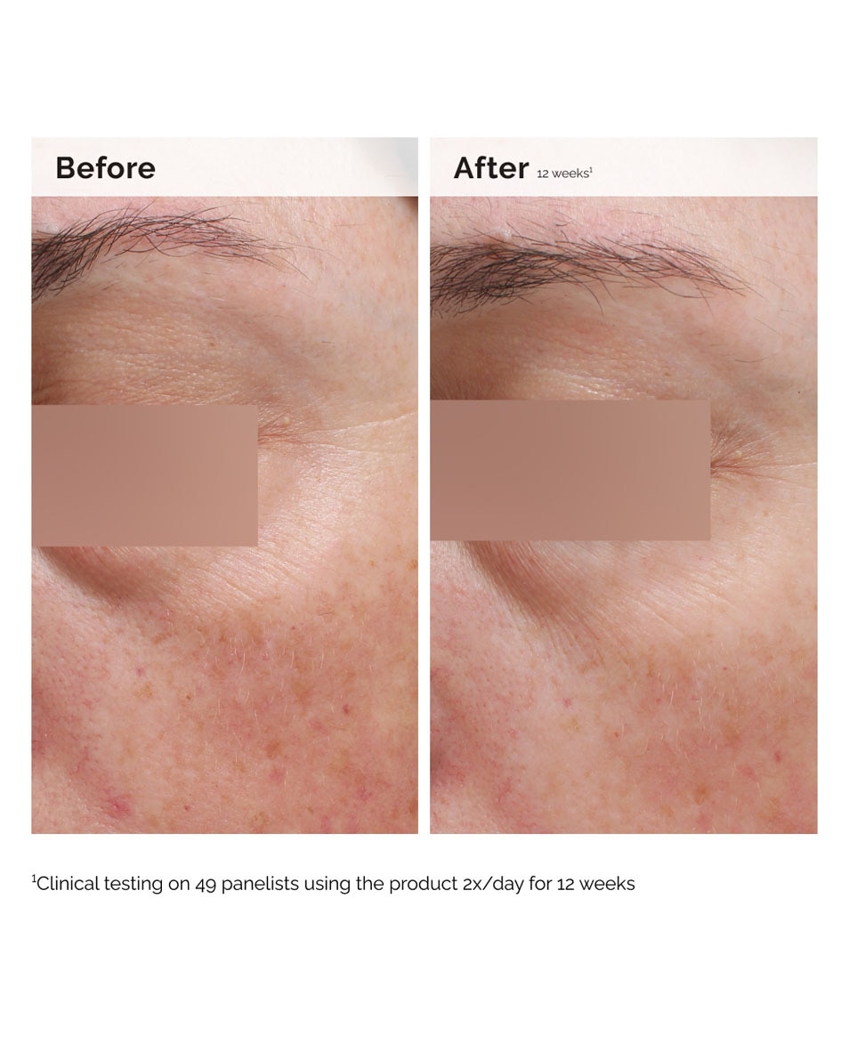 THE ORDINARY UNEVEN SKIN TONE/BRIGHTNER ÉMULSION VISAGE ET CORPS À LA NIACINAMIDE 5% 100 ML 3