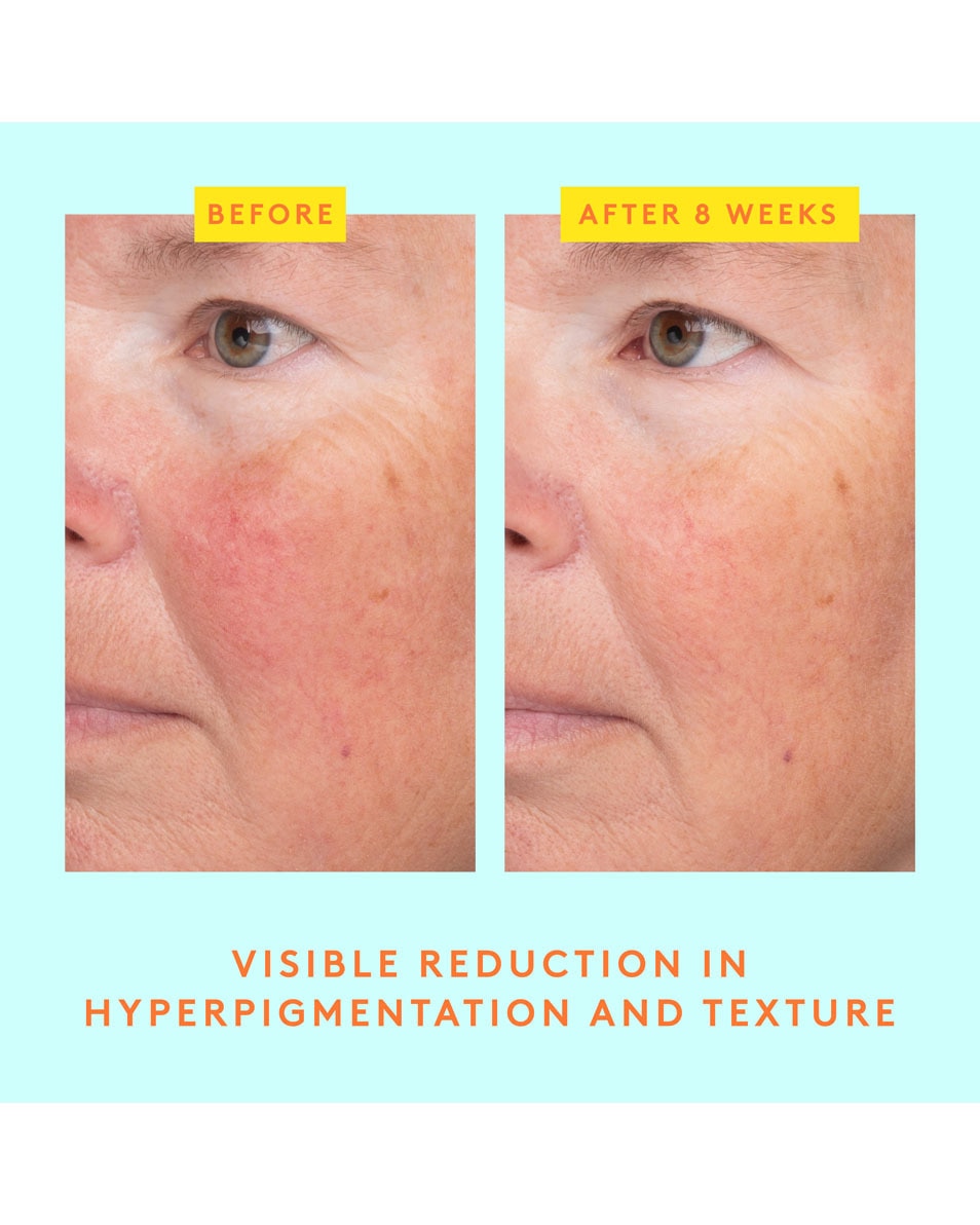 C-Luma™ Hydrabright Serum