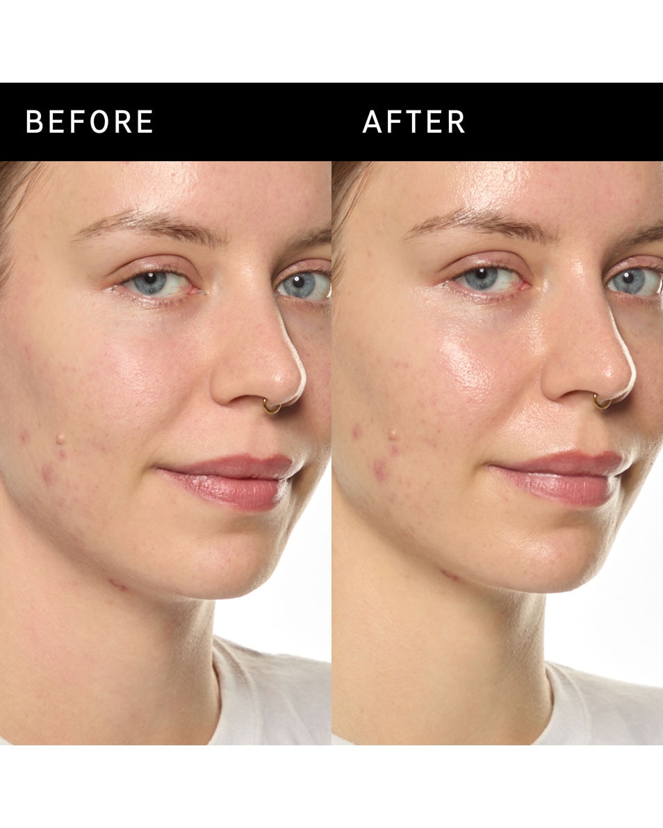 The Inkey List Ectoin Hydro-Barrier Serum Sérum hydro-protecteur à l’éctoïne 30 ML 3