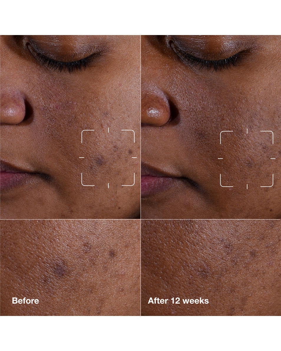 CLINIQUE Even Better Clinical™ Dark Spot Clearing Serum Serum 50 ML 3