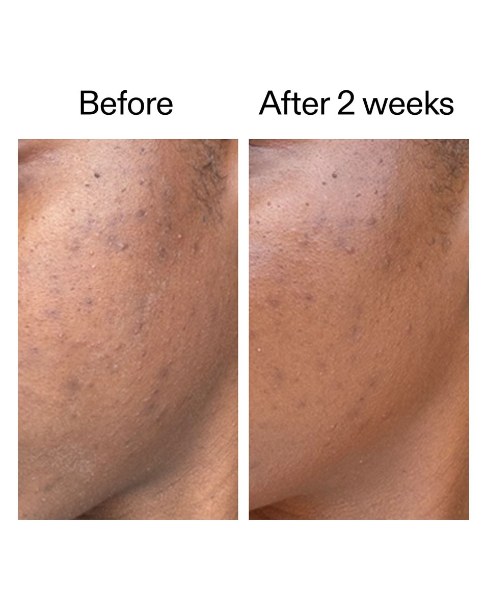 Barrière Huidverzorgingsset