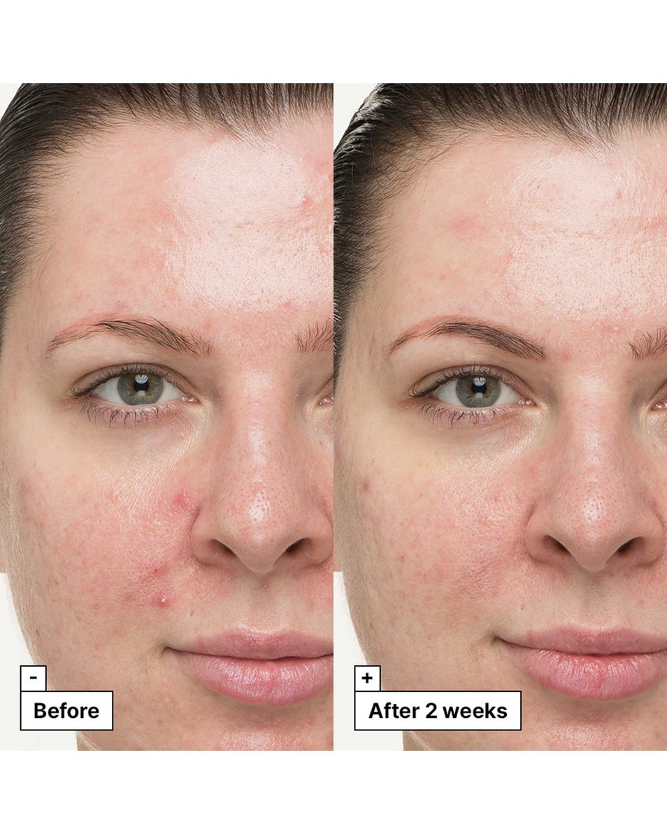 DR JART+ Cicapair Kalmerende Behandeling 30 ML