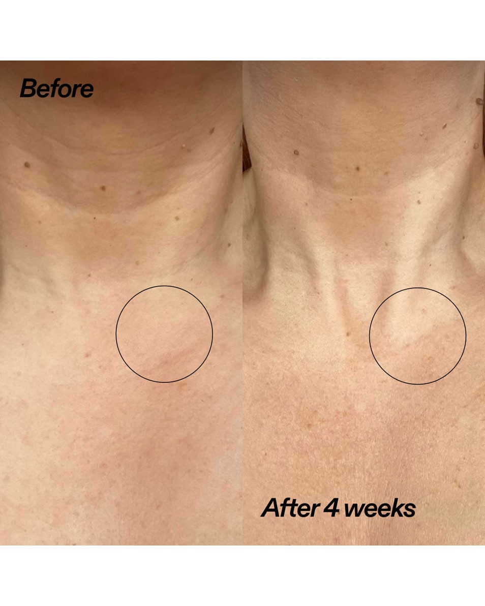 The Inkey List Bio-active Ceramide Neck Stick Nek Stick 20 G 3