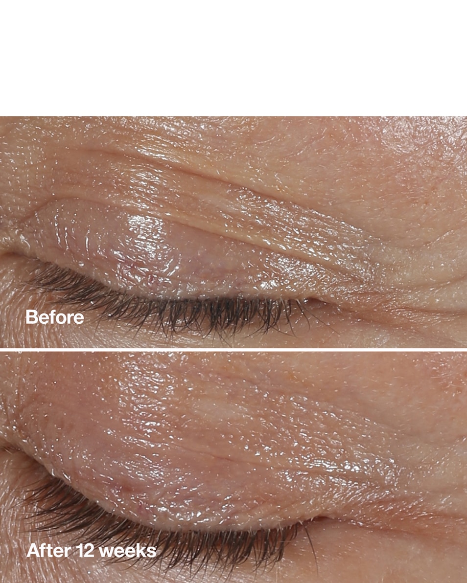 CLINIQUE SMART CLINICAL REPAIR™ WRINKLE CORRECTING EYE CREAM OOGCRÈME - ANTI-AGING & HYDRATEREND - VERMINDERT RIMPELS 15 ML 3