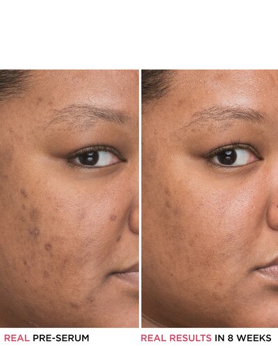 IT COSMETICS BYE BYE SERUM IT BYE BYE DARK SPOTS NIACINAMIDE SERUM 30 ML