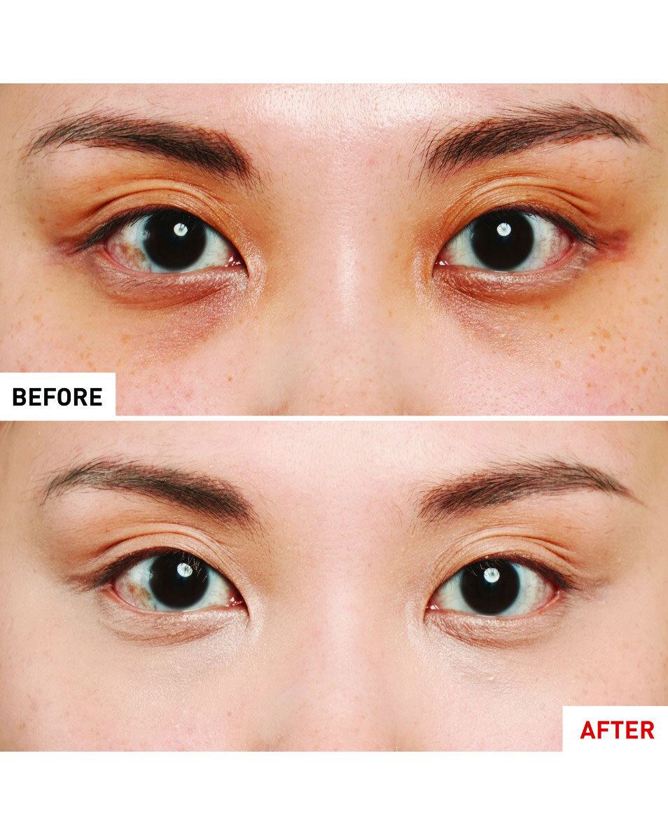 ERBORIAN Super BB Concealer Anticernes-soin couvrant CHAMPAGNE 6