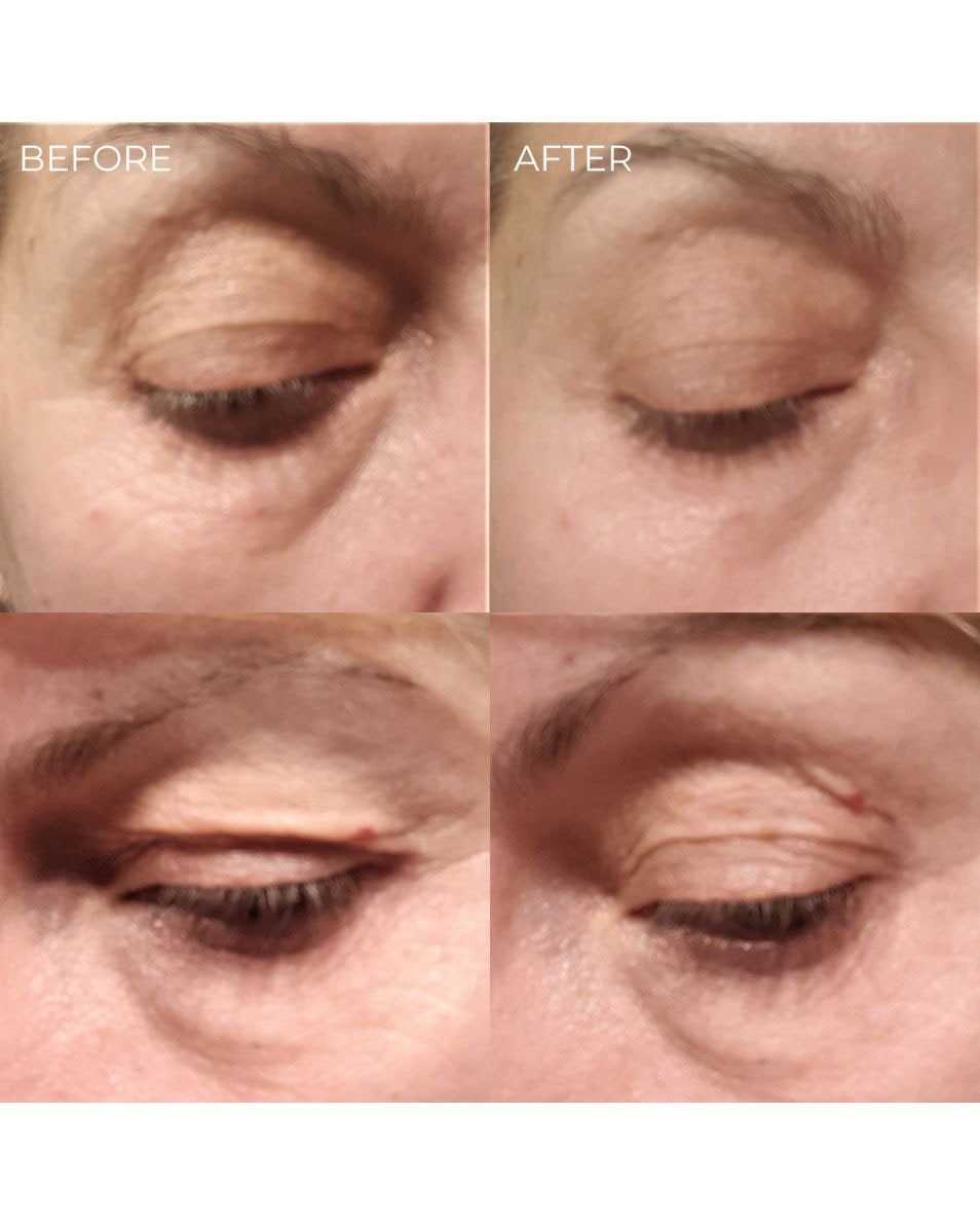 BEAUTICAL INSTANT LIFTING SERUM VERMINDERING VAN FIJNE LIJNTJES EN RIMPELS 15 ML 4