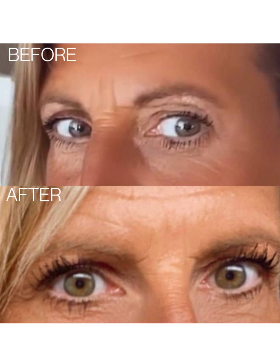 LANGERE, DICHTERE EN DIKKERE WIMPERS