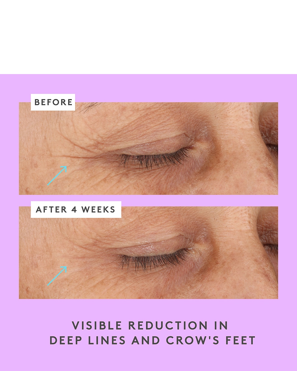 CERAMIGHTY™ AF BAUME POUR LES YEUX