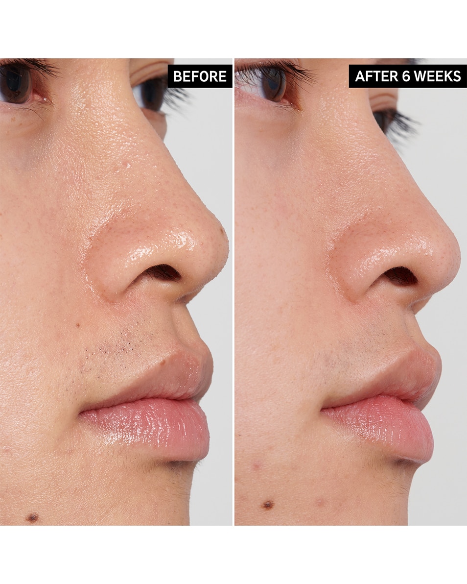 The Inkey List PHA TONER TONIQUE PHA 100 ML 4