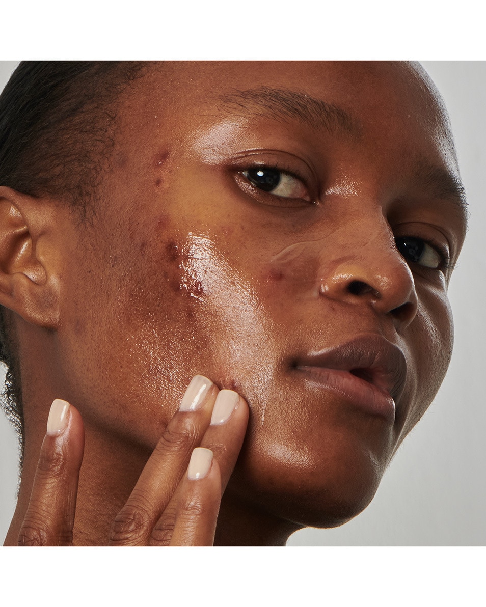 The Inkey List SUPERSOLUTIONS SÉRUM 20 % NIACINAMIDE 30 ML 4