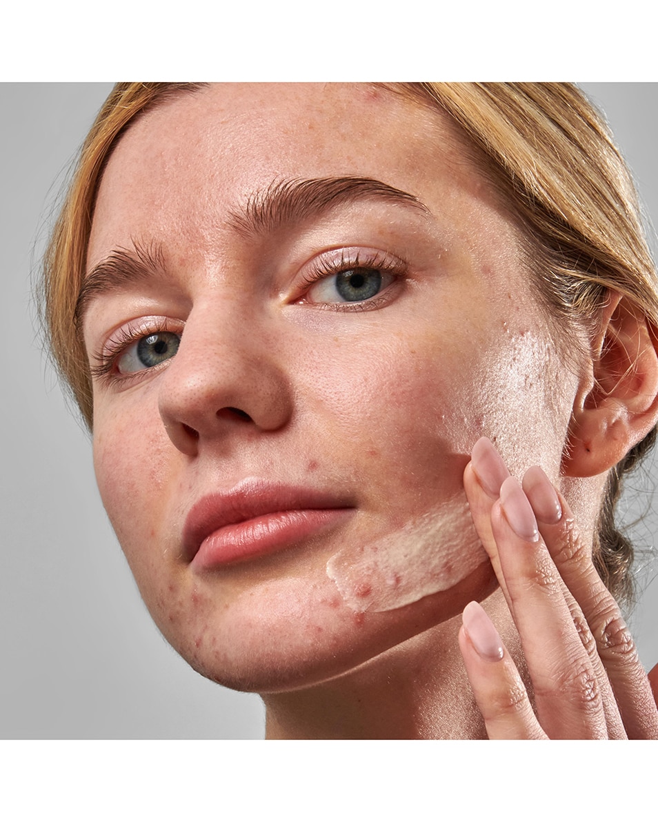 SOIN HYDRATANT ANTI-IMPERFECTIONS AVEC 2 % DE NOVORETIN