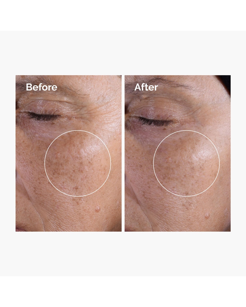 Glycolic Acid 7% Exfoliating Toner