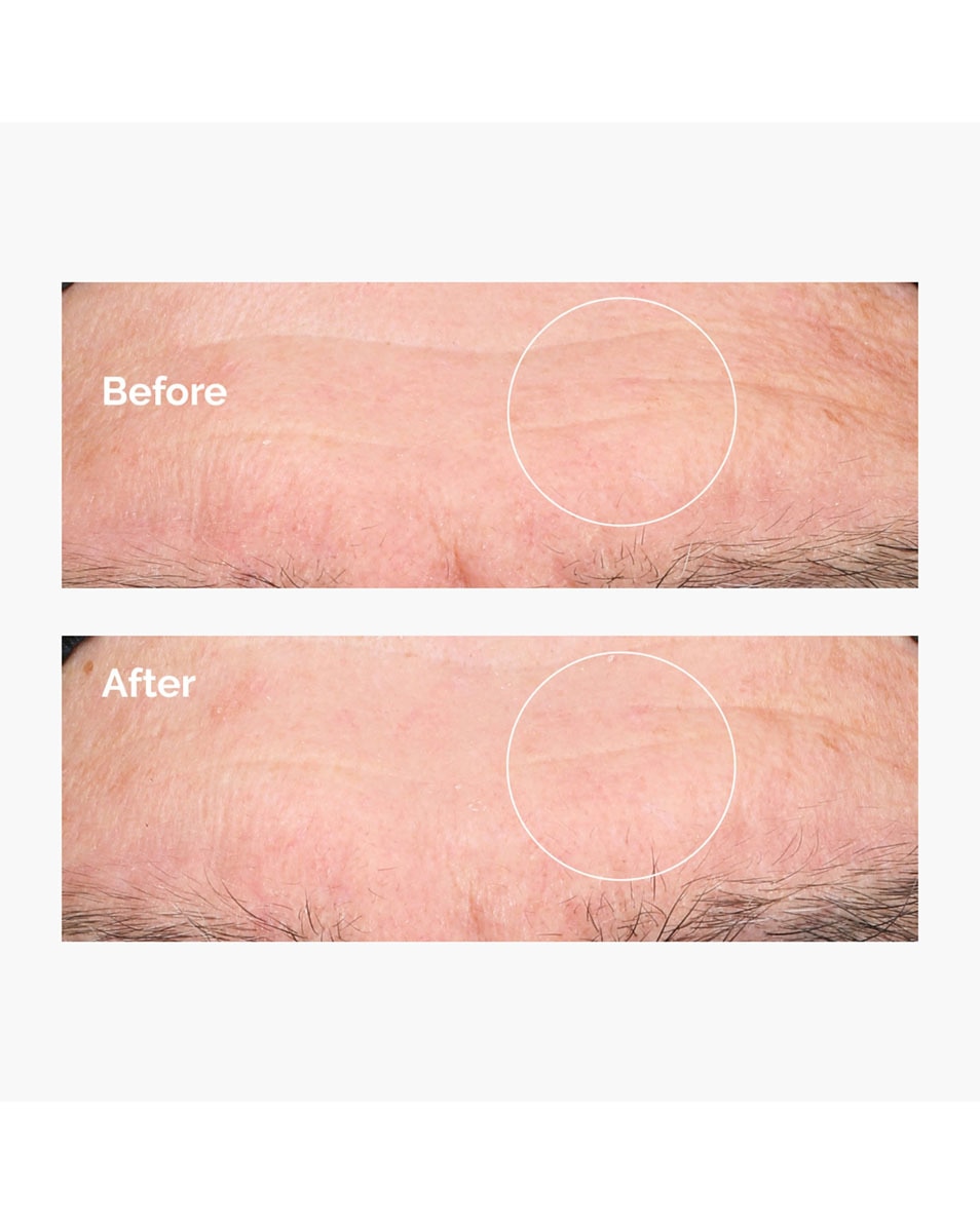 THE ORDINARY Dryness & Dehydratation Hyaluronic Acid 2% + B5 60 ML