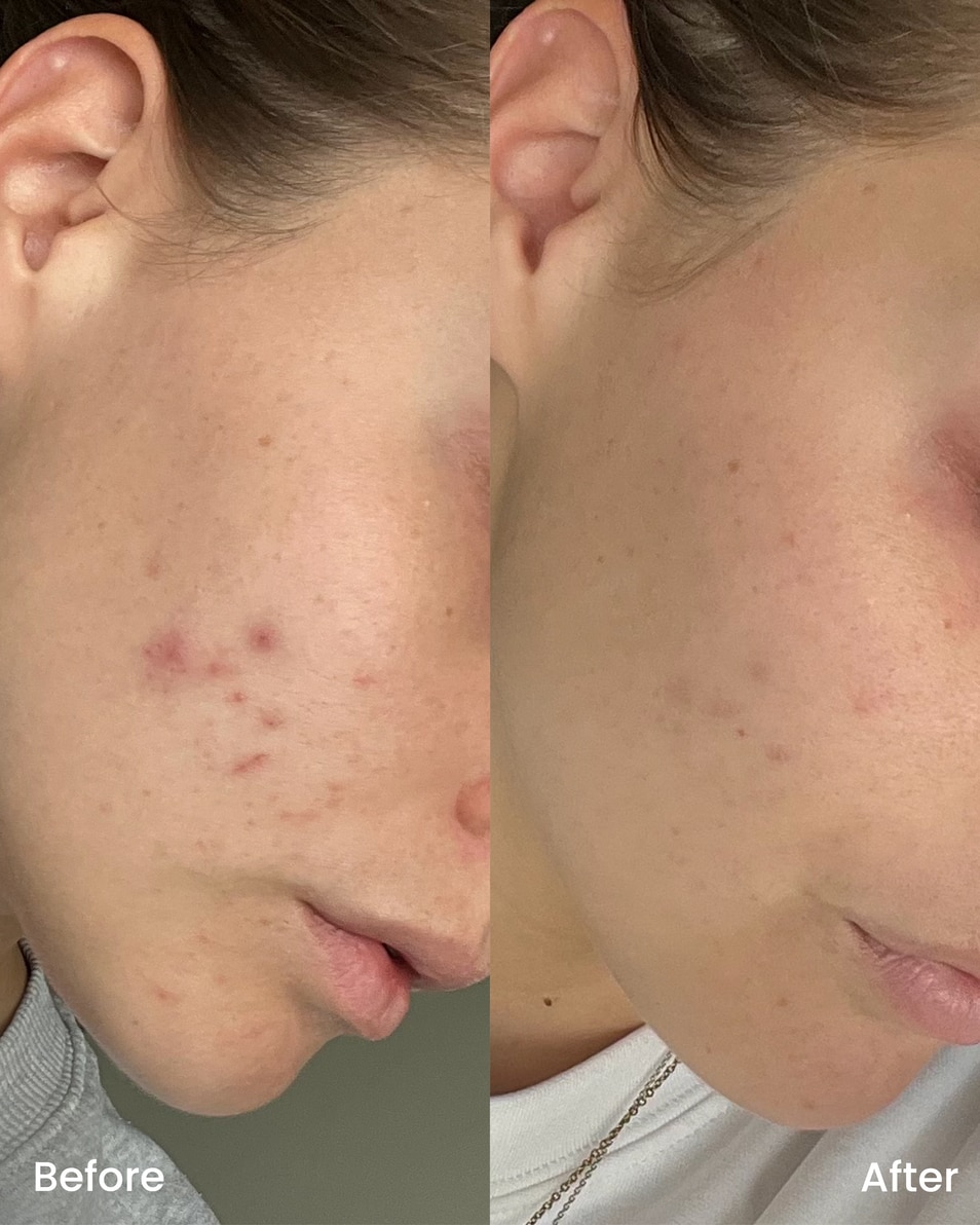 CLAY AND GLOW Spot treatment gel Gel traitant ciblé BHA 15 ML 4