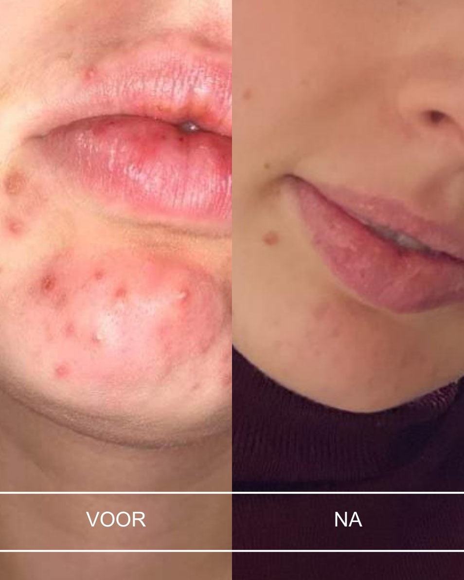 Milde gelaatsscrub - zuiverend