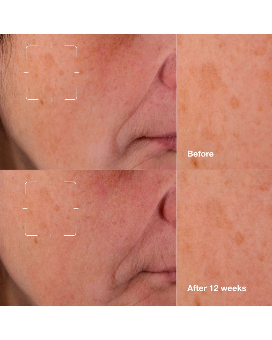 CLINIQUE Even Better Clinical™ Dark Spot Clearing Serum Serum 50 ML 4