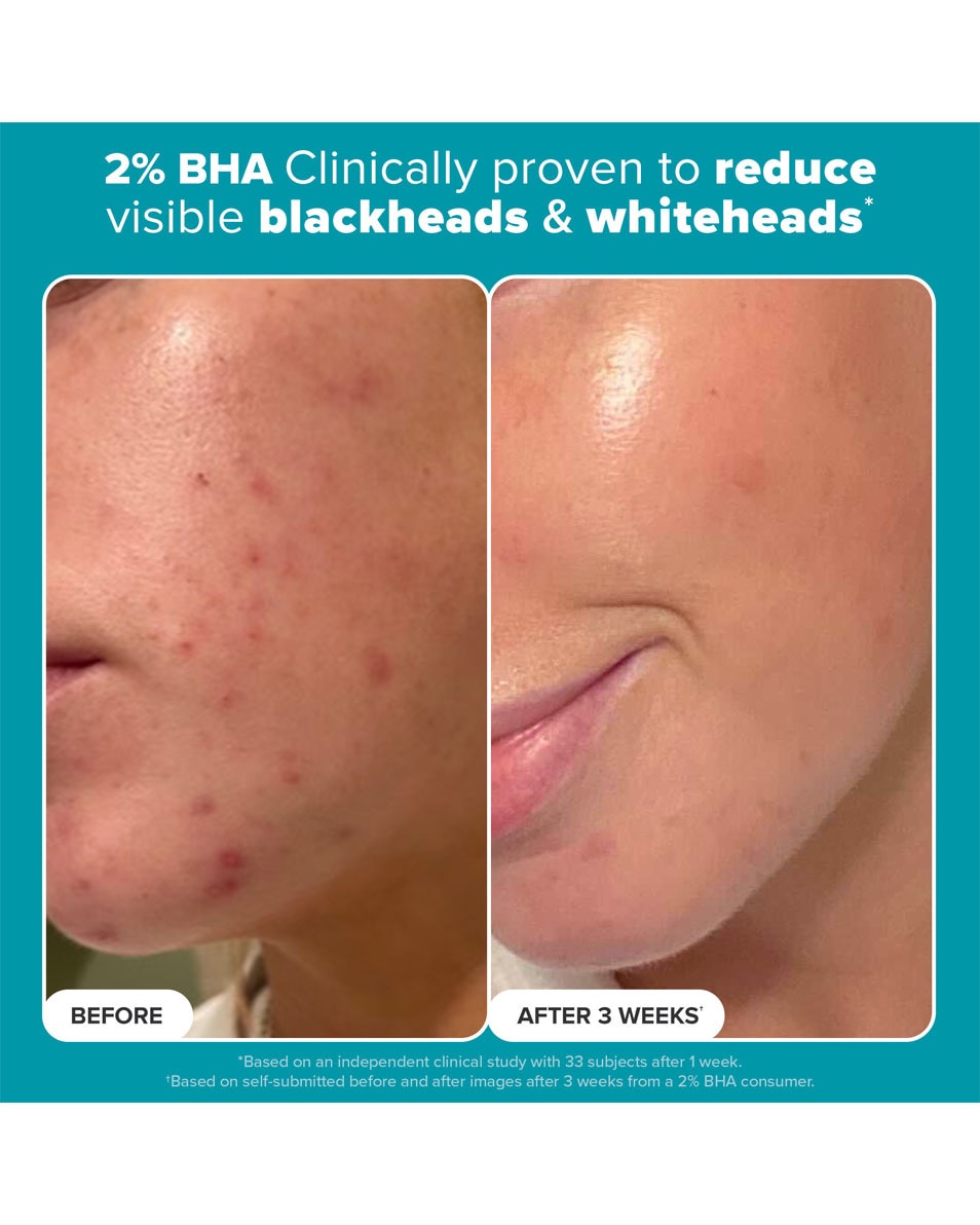 Duo Découverte Exfoliants AHA + BHA