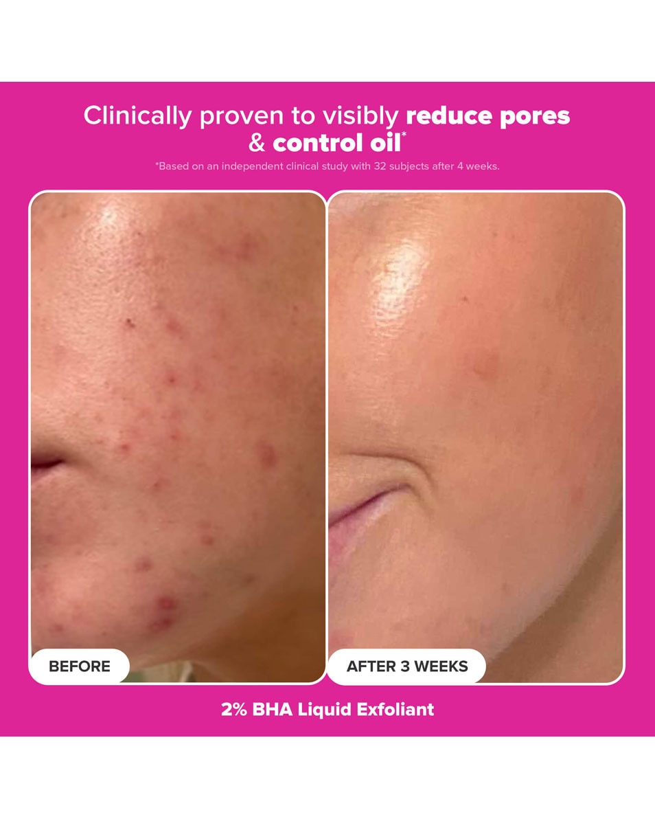 Duo Éclat + Repulpant