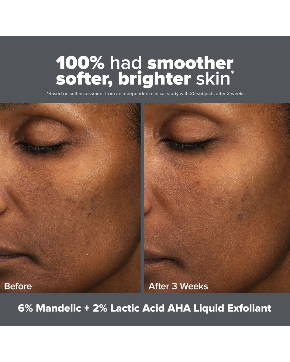 SKIN PERFECTING Lotion Exfoliante 6 % Acide Mandélique + 2 % Acide Lactique