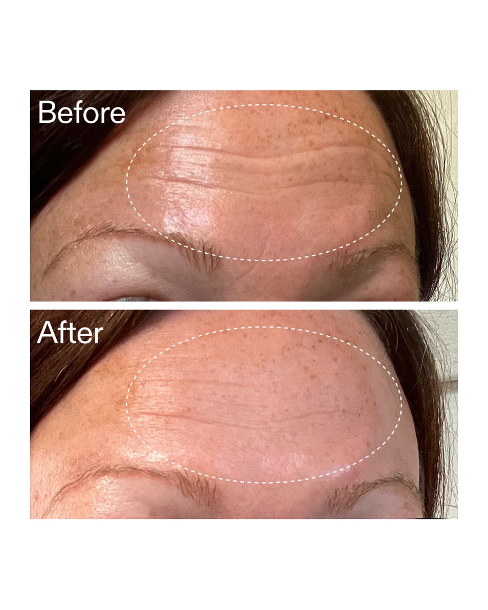 The Inkey List Starter Retinol Serum Retinol Serum voor Beginners 30 ML 4