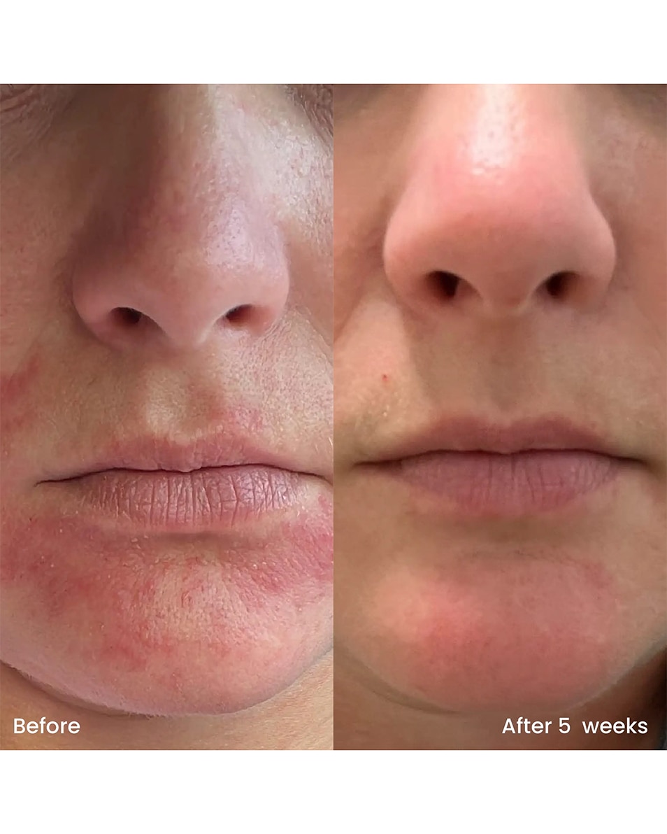 CLAY AND GLOW HYDRATING MOISTURIZER CRÈME DE JOUR HYDRATANTE 75 ML 4