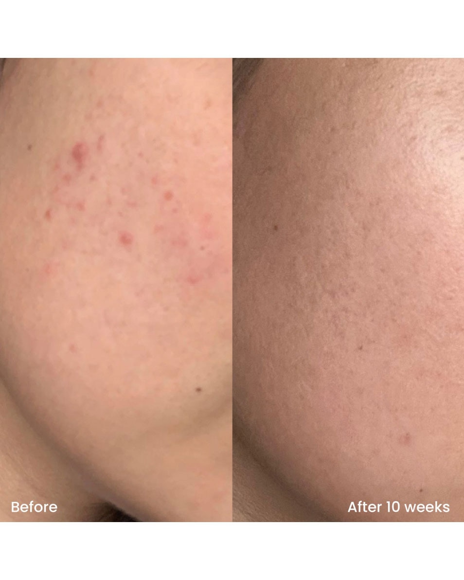 CLAY AND GLOW TRIPLE AHA STRAW-JELLY CLEANSER GEL NETTOYANT DOUX 250 ML 3