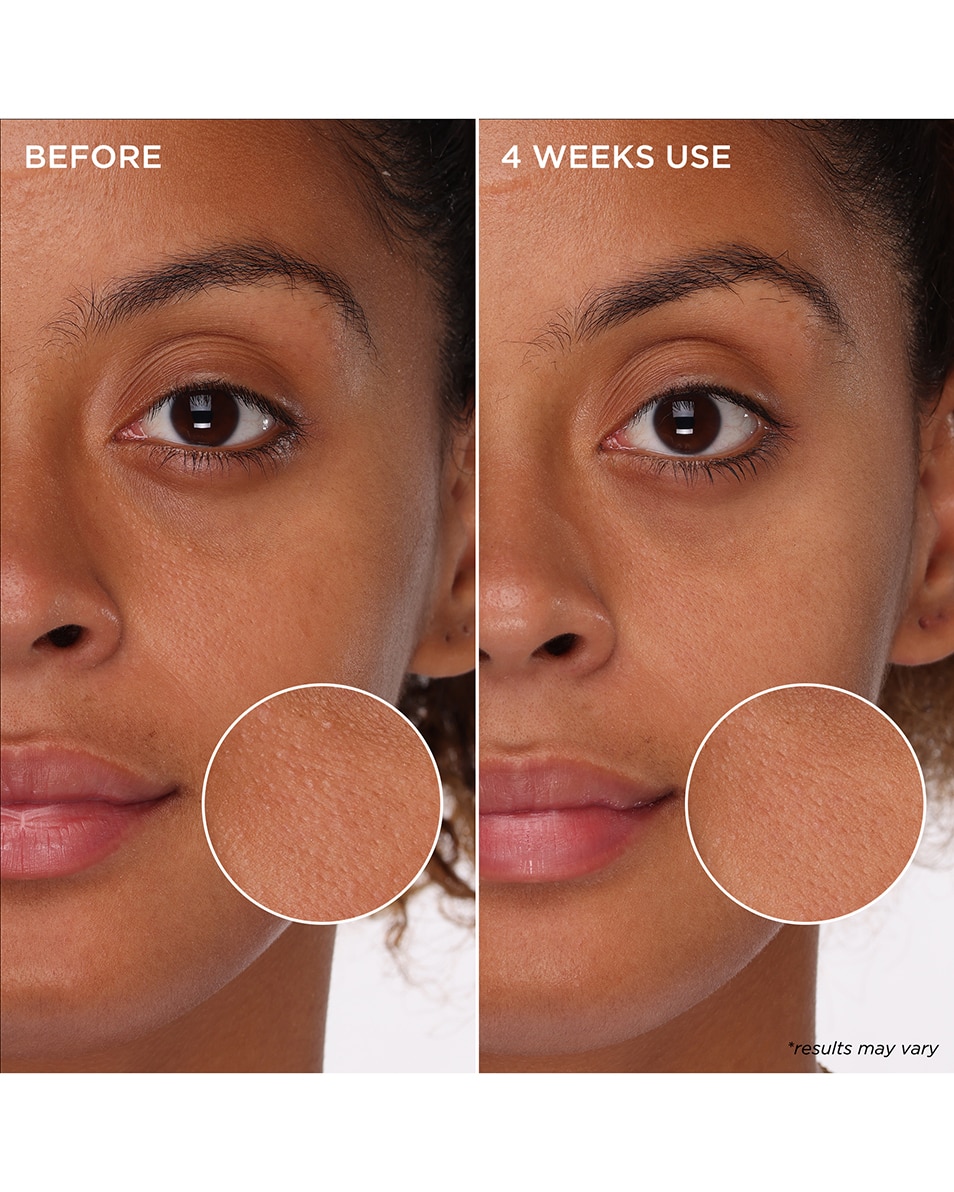 BENEFIT COSMETICS PORECARE SKINCARE THE POREFESSIONAL TIGHT 'N TONER MINI - MOUSSE TONIQUE AHA + PHA POUR AFFINER LES PORES 60 ML 4