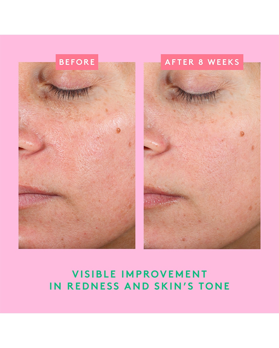 Bora Barrier™ Crème réparatrice