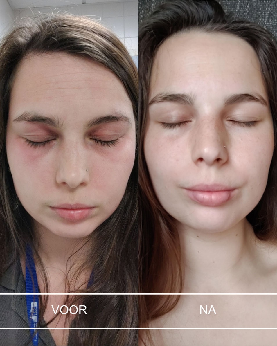 Voedende dagcrème - voor alle huidtypes