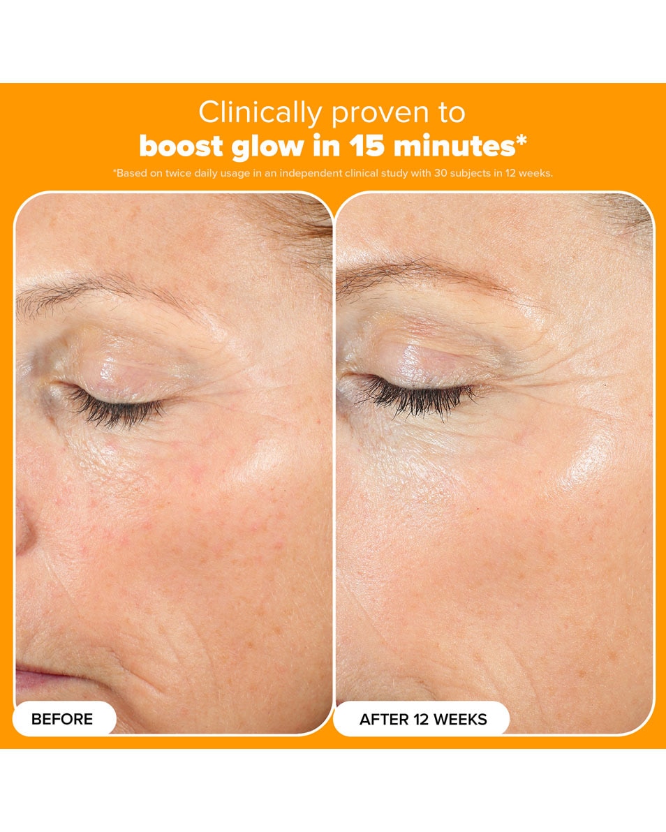 Booster 15 % Vitamine C