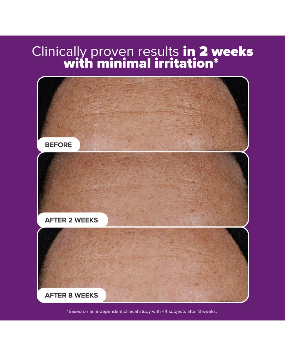 CLINICAL Pro Retinaldehyde Dual-Retinoid Treatment
