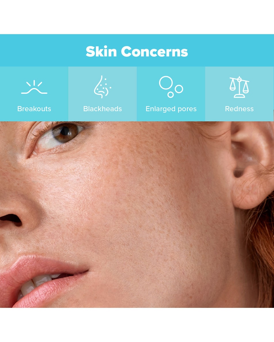 Kit Best-Sellers Anti-Imperfections