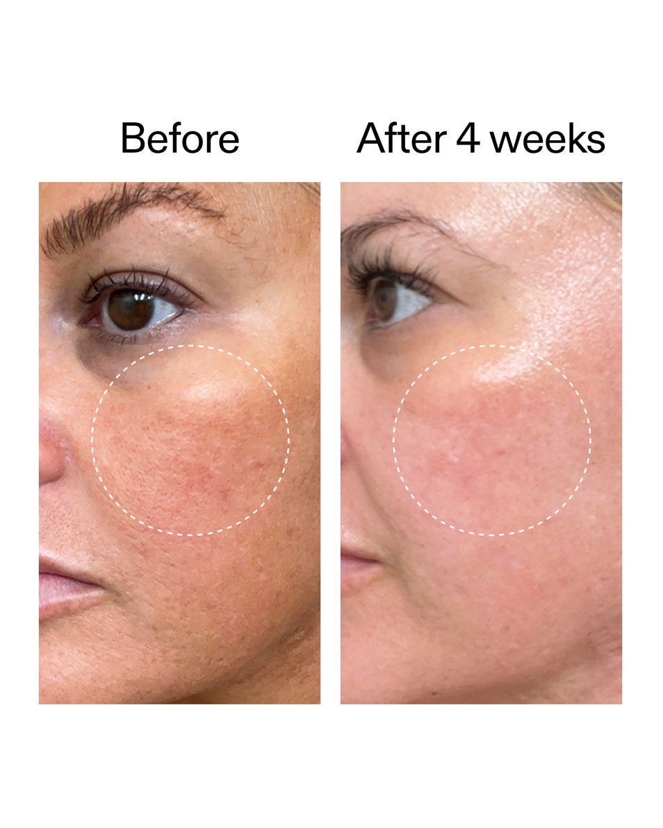 The Inkey List Starter Retinol Serum Retinol Serum voor Beginners 30 ML 5